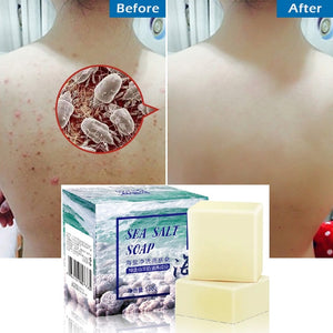 100g Removal Pimple Pores Acne Treatment Sea Salt Soap