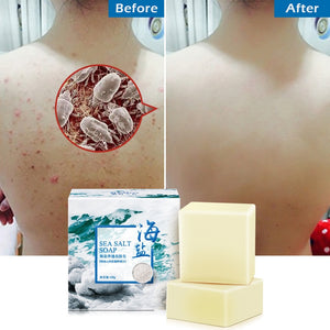 100g Removal Pimple Pore Acne Treatment Sea Salt Soap