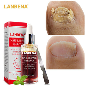 LANBENA Fungal Nail Repair Essence Serum